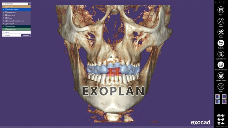 نرم افزار ExoPlan